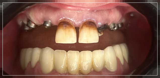 Öncesi: After Before