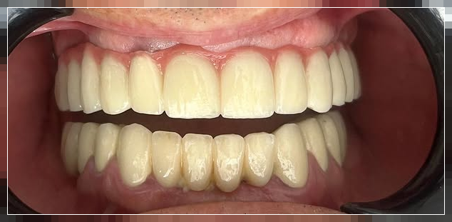 Sonrası: After Before